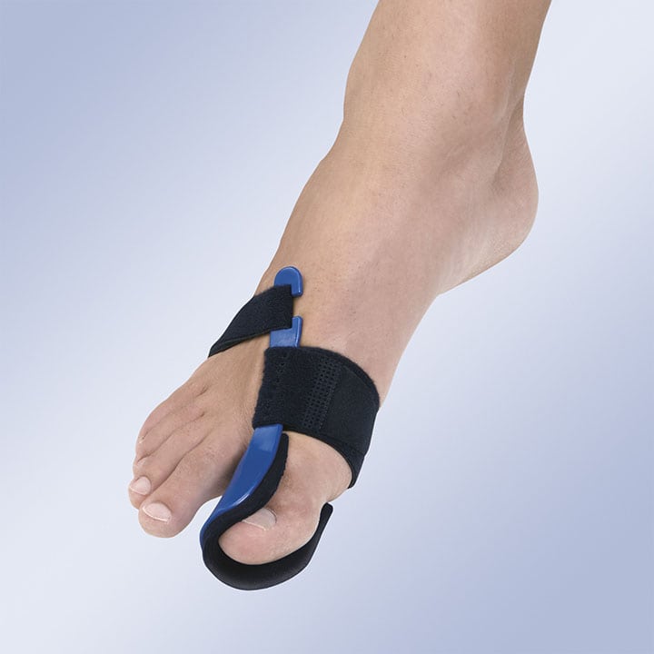 HALLUX-VALGUS IN THERMOPLASTIC