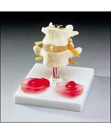 Budget Lumbar Vertebrae With Interchangeable Discs