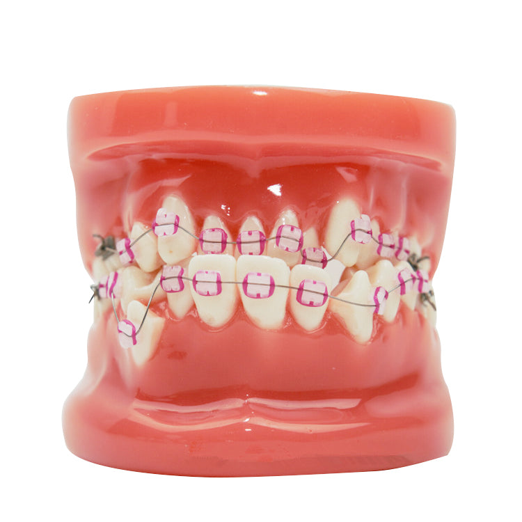 Dental Orthodontics Teeth Model Dental Orthodontic Educational Demonstration Teeth Model