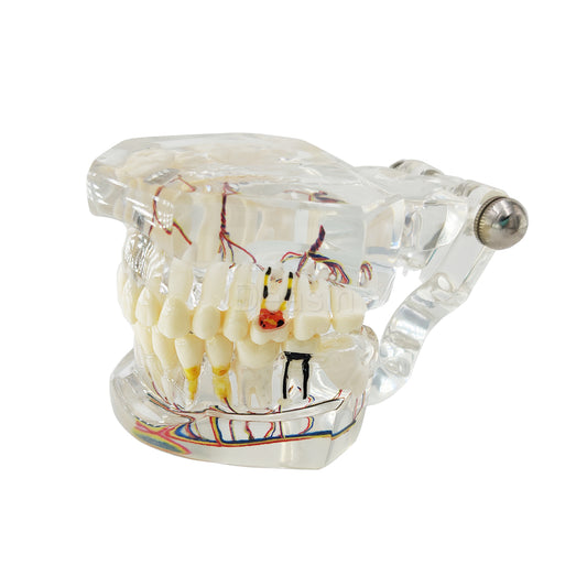 Anatomical model of dental accessory nerve,Teaching transparent model teeth pathology model