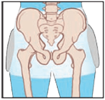 Women's ComfiHips Hip Protector - Replacement Undergarments