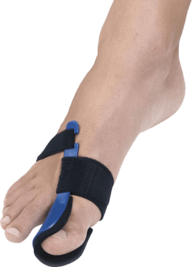 HV-33 Hallux-Valgus in Thermoplastic Left